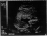 Picture 1